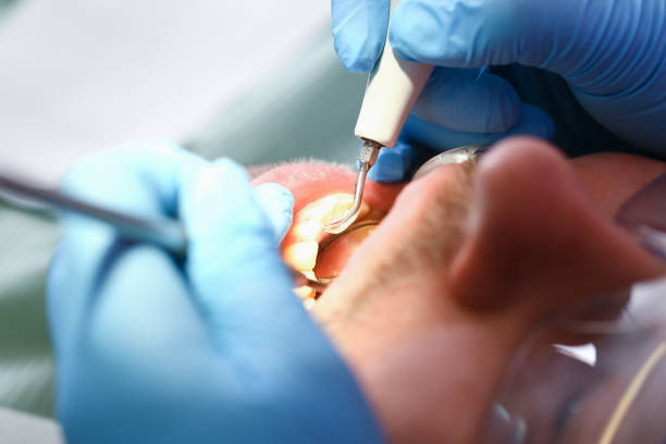 Best Emergency Cosmetic Dentistry in Chapel Hill, TN