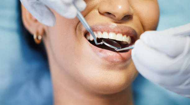 Best Emergency Dentist for Knocked-Out Tooth in Chapel Hill, TN