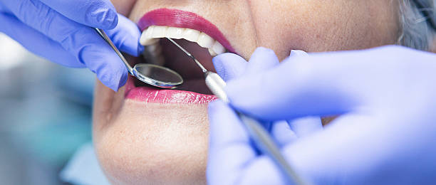 Best Emergency Dental Care for Abscessed Tooth in Chapel Hill, TN