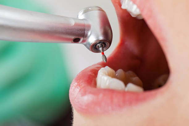 Best Emergency Dentist for Knocked-Out Tooth in Chapel Hill, TN